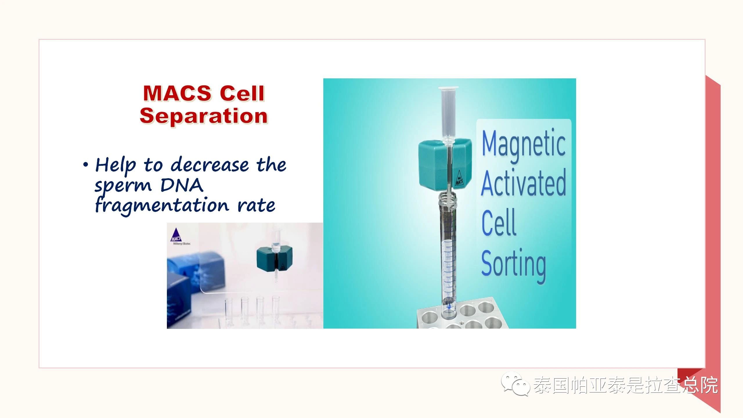 MACS精子磁筛检查技术，检查DNA碎片率！