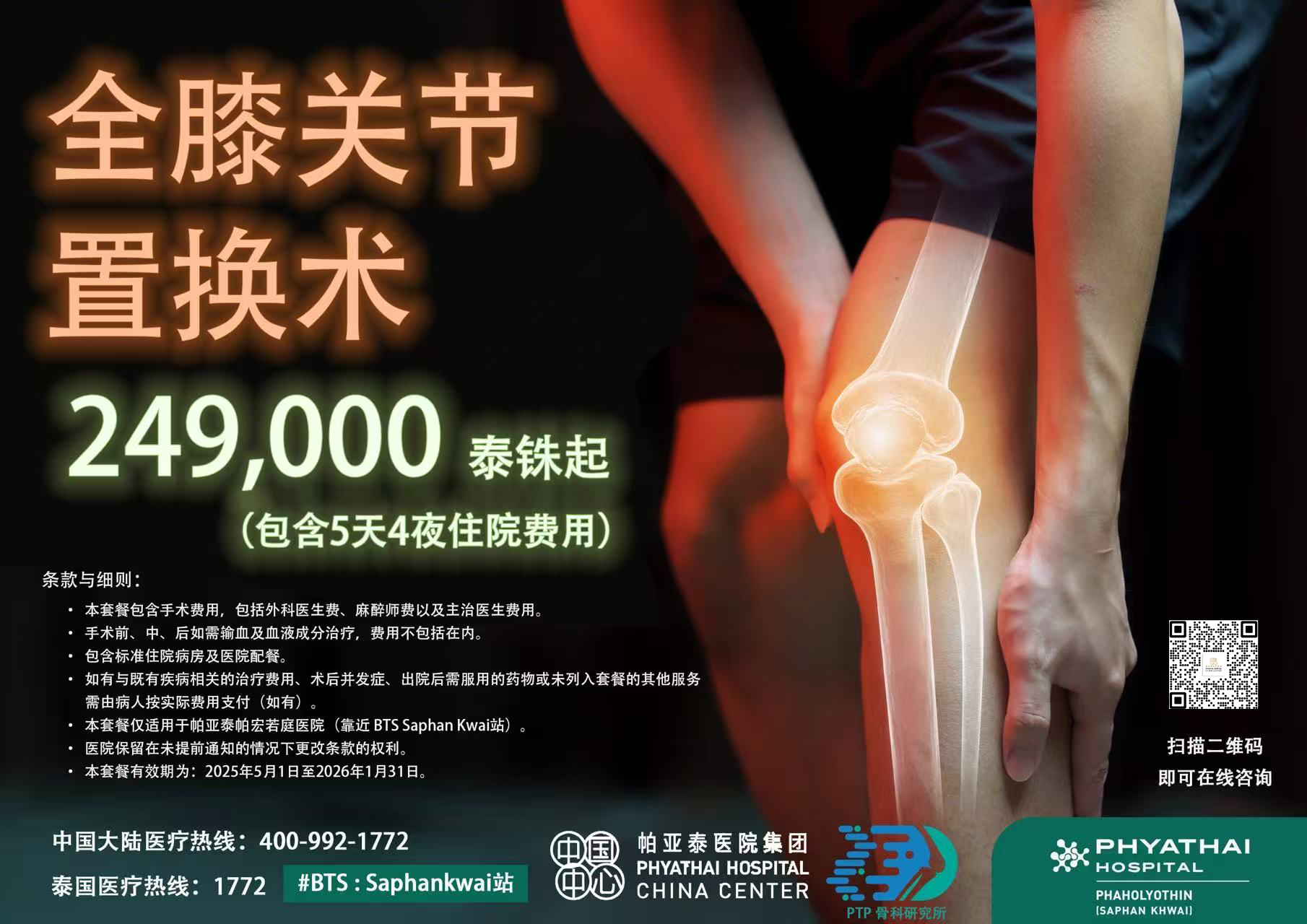 全膝关节置换手术